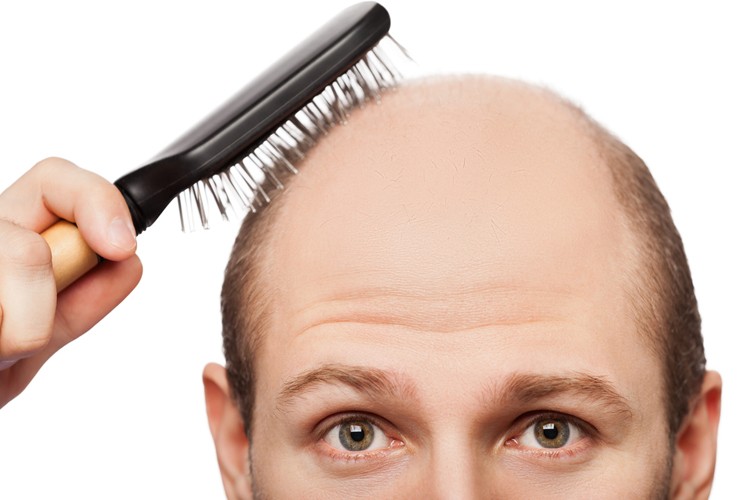 Как отрастить выпавшие волосы дома натуральным средством
