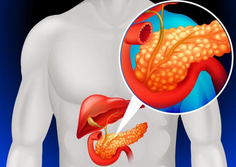 Панкреатит картинки для презентации