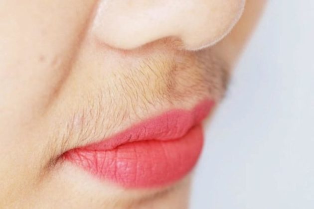 7 причин появления усов у женщин и как от них избавиться. Рекомендации врачей