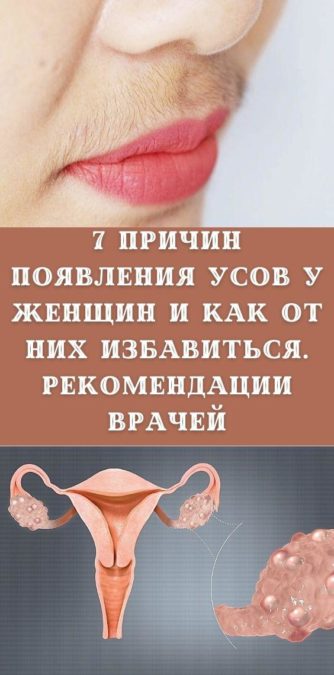 7 причин появления усов у женщин и как от них избавиться. Рекомендации врачей